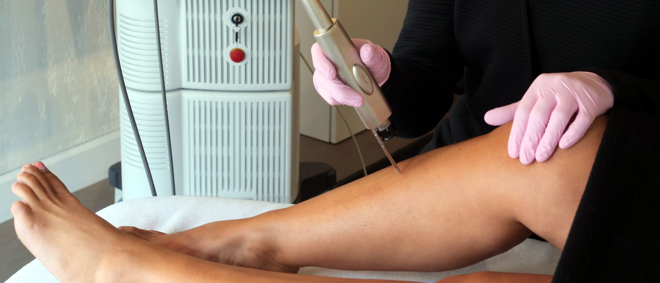 Séance d'épilation laser sur la jambe à la clinique Esthétèque